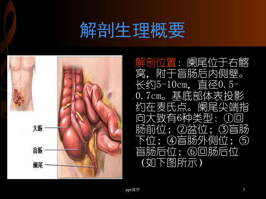 阑尾炎-课件(同名348).ppt_第3页