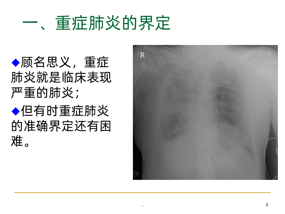 重症肺炎的诊治课件-参考.ppt_第3页