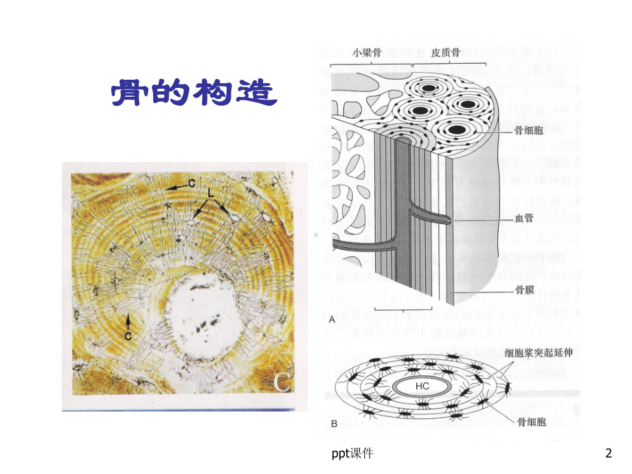 骨折愈合过程-课件.ppt_第2页