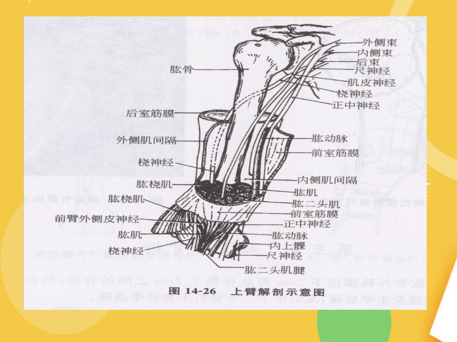 肱骨骨折护理查房完整资料课件.ppt_第3页