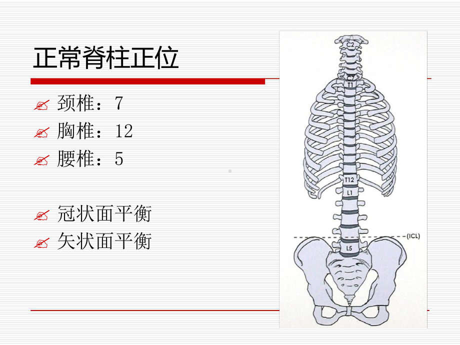 脊柱侧弯完整版最新优质课件.ppt_第2页