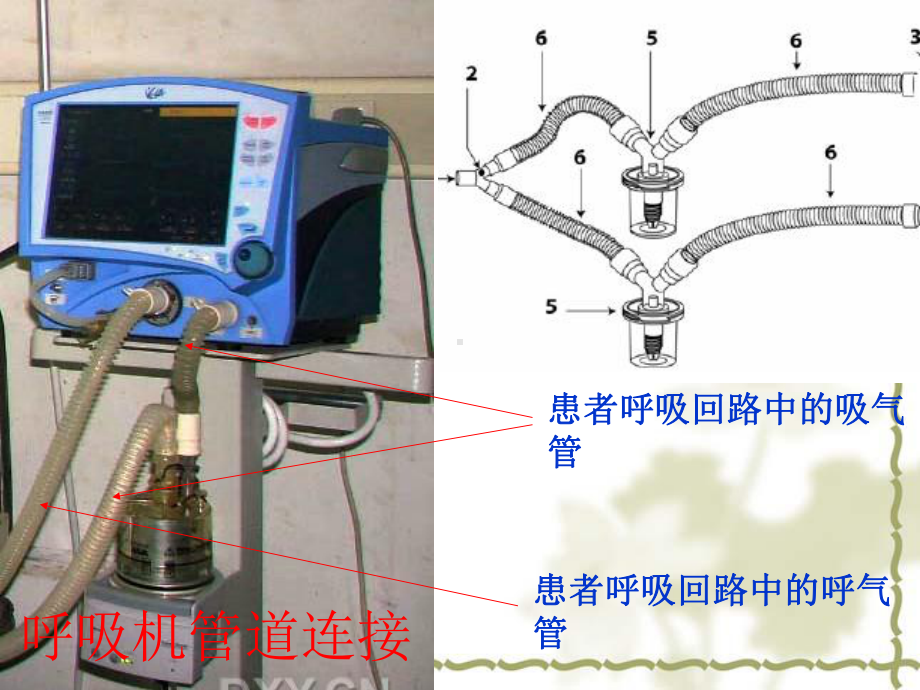 美国鸟牌呼吸机使用课件.pptx_第3页