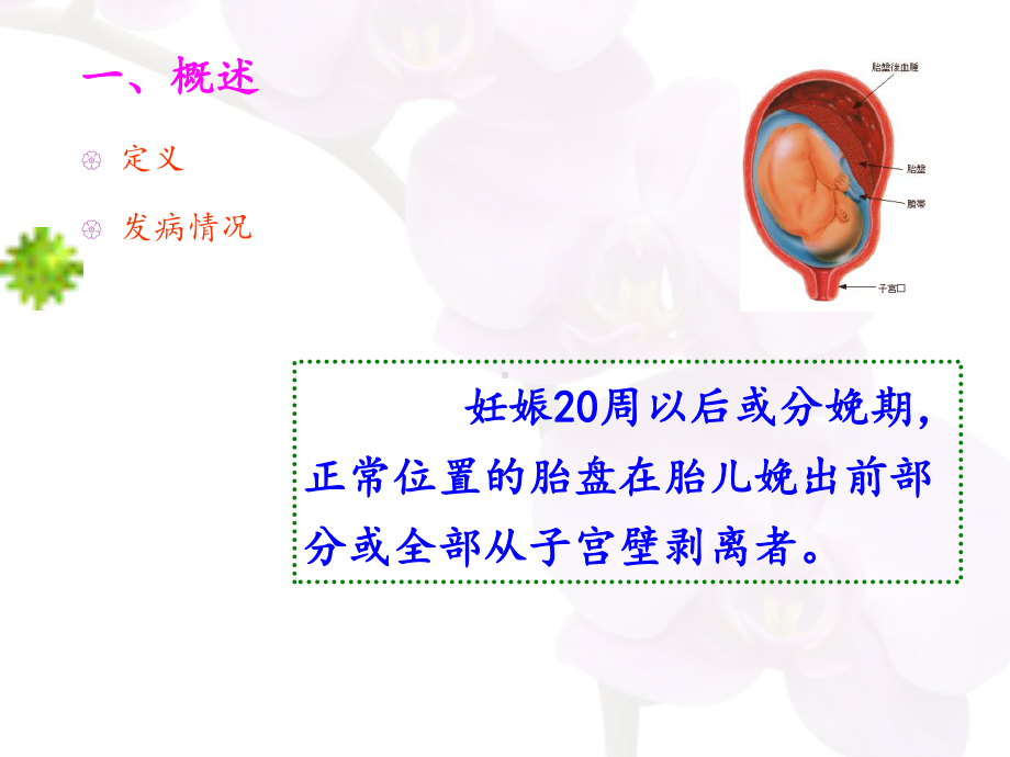 胎盘早剥护理课件.ppt_第3页