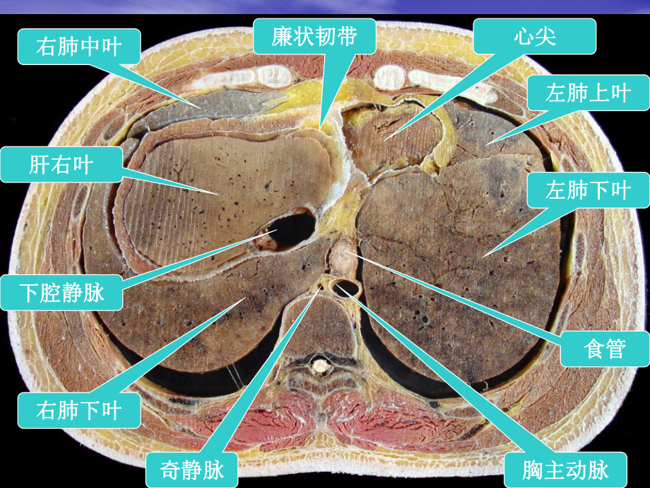 腹部的横断层解剖课件.ppt_第2页