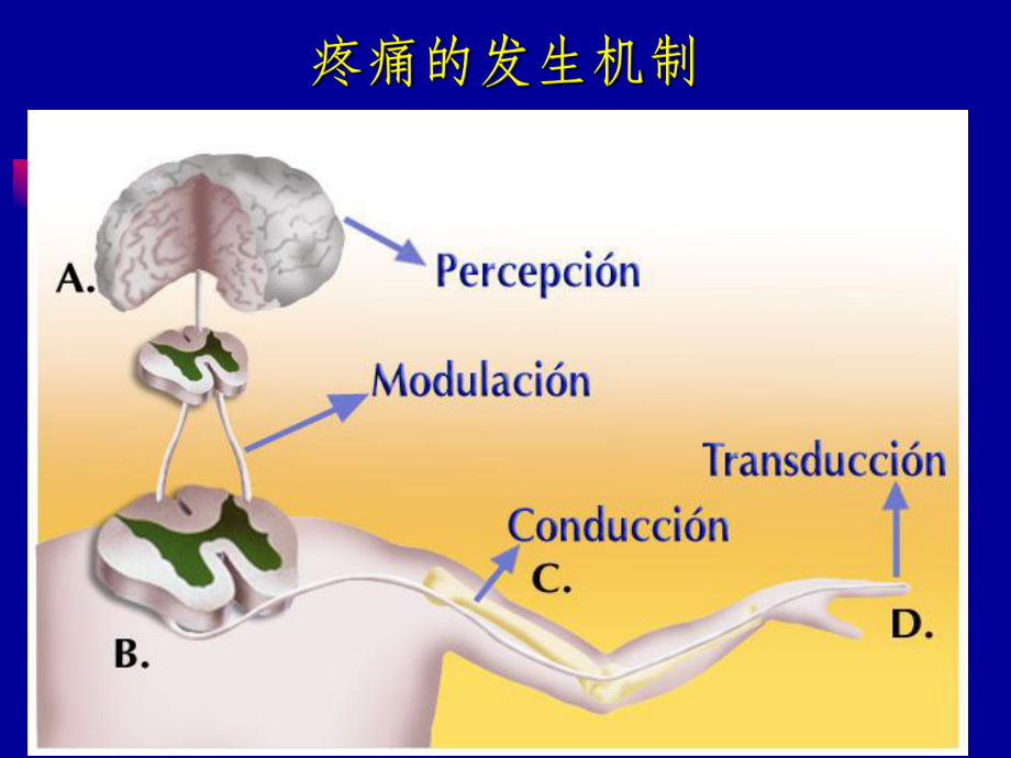 疼痛诊疗学第六章微创介入治疗课件.ppt_第3页