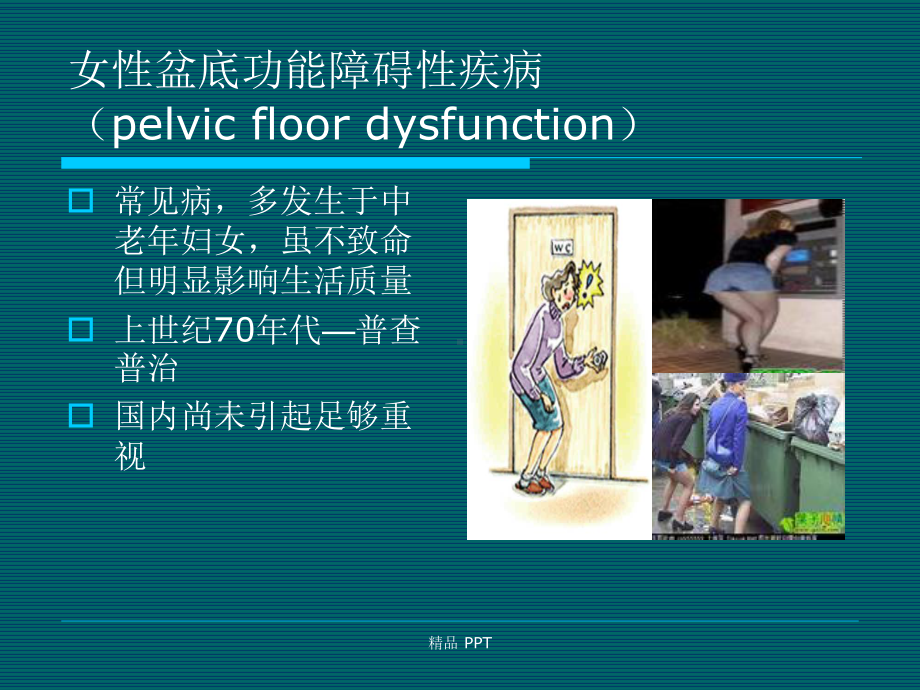 腹腔镜在盆底功能障碍性疾病中的应用课件.ppt_第3页