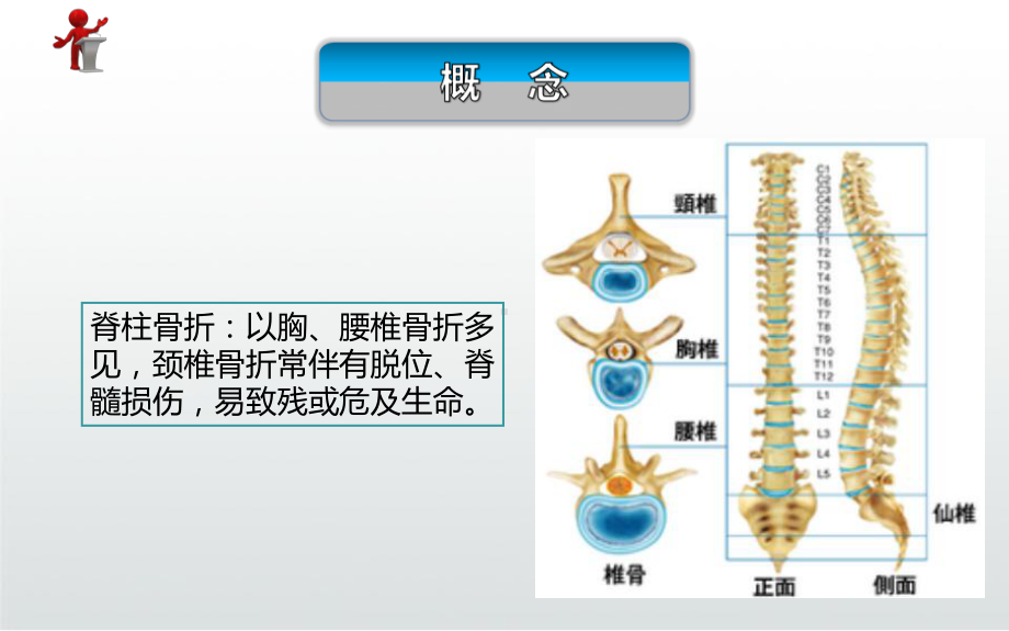 脊柱骨折的护理PPT课件.ppt_第3页