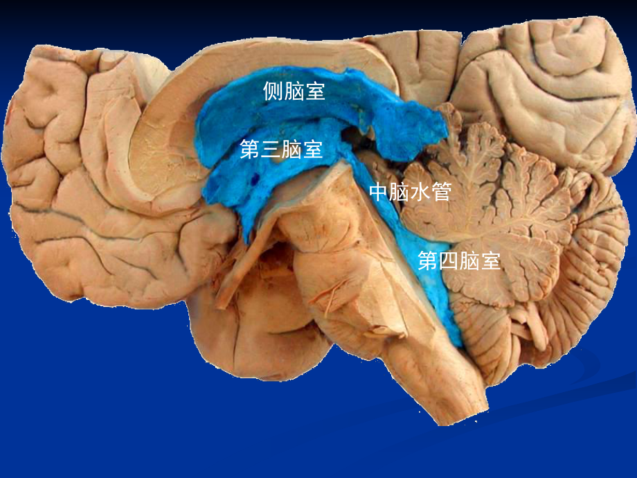 脑室系统解剖及第三脑室手术入路汇总课件.ppt_第3页