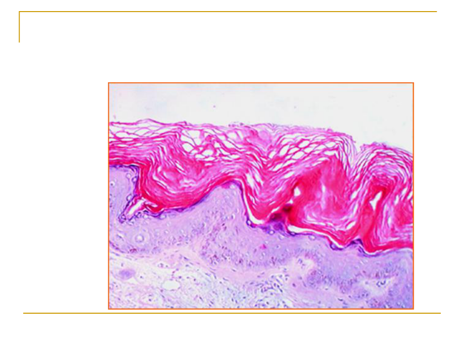 皮肤组织病理课件.ppt_第3页