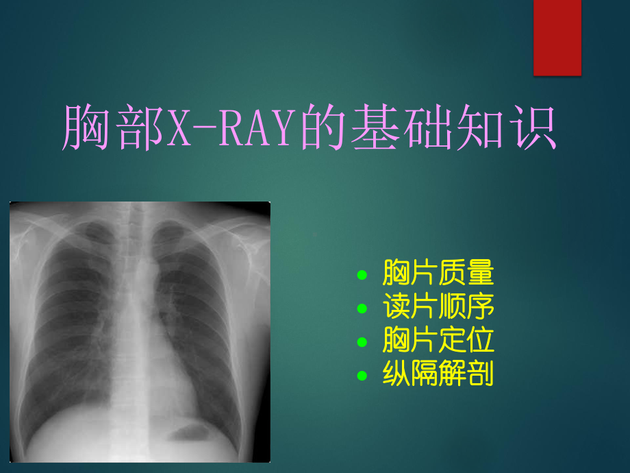 肺部影像学课件.pptx_第2页