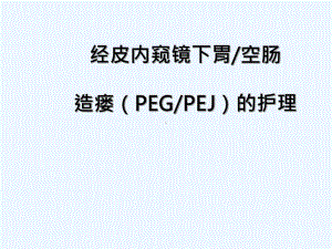 经皮内窥镜下胃空肠造瘘PEGPEJ的护理课件.ppt