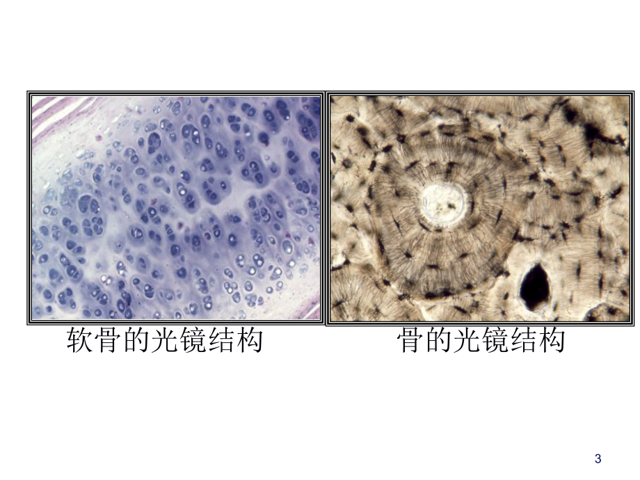 软骨和骨讲义课件.ppt_第3页