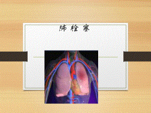 肺栓塞教学讲解课件讲义.ppt