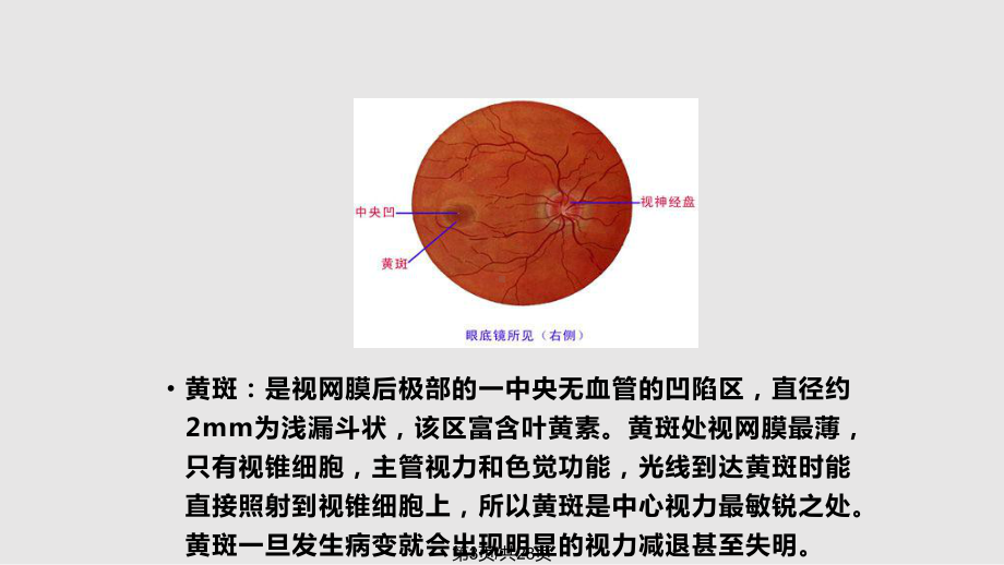 老年性黄斑变性课件.pptx_第3页