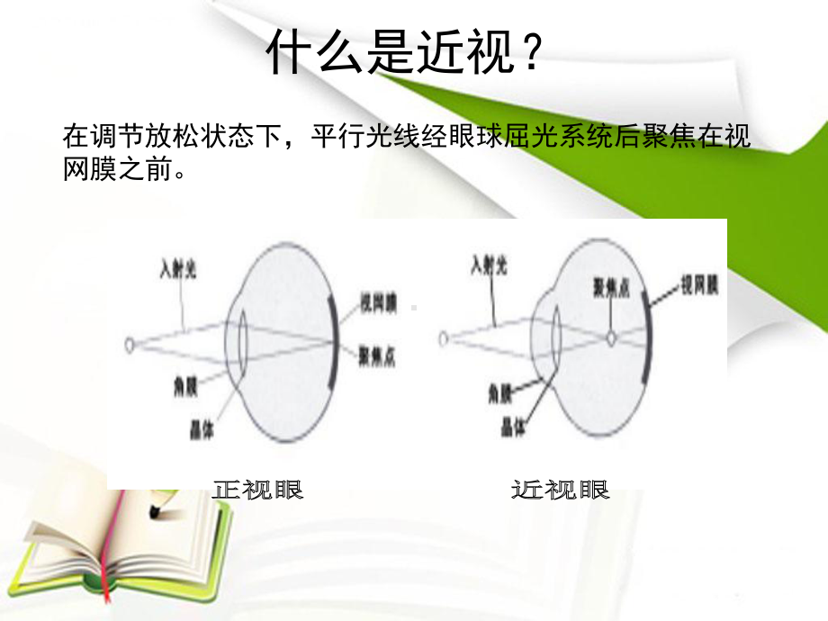 角膜塑形镜讲课课件.pptx_第3页