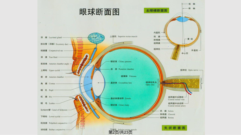 老年人常见眼病课件.pptx_第2页