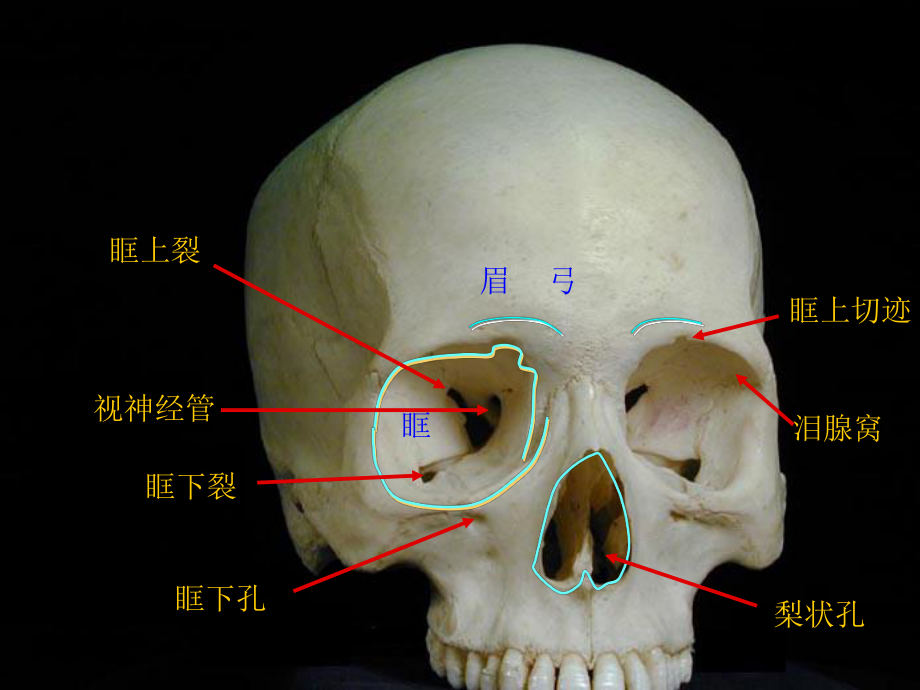 眼眶影像学解剖课件.ppt_第3页