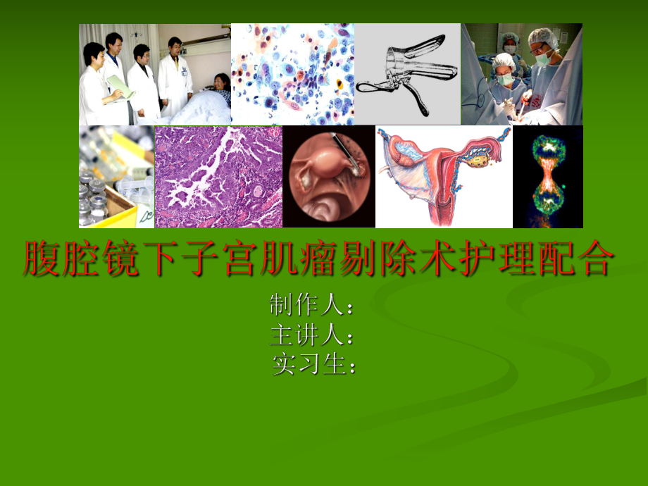 腹腔镜下子宫肌瘤剔除术护理配合课件.ppt_第1页