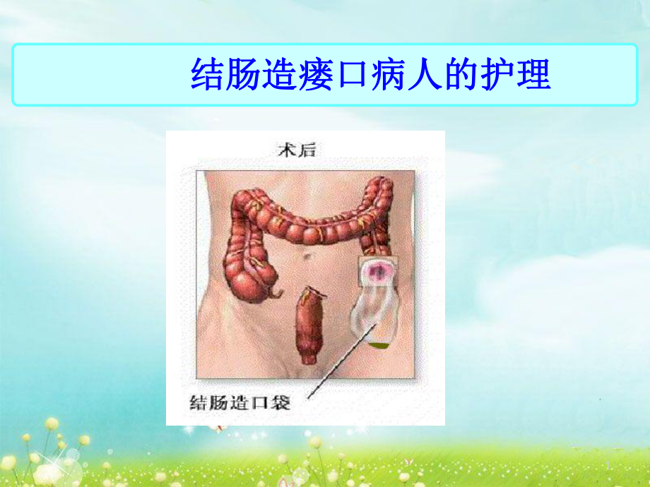 结肠造瘘口病人的护理教学课件.ppt_第1页