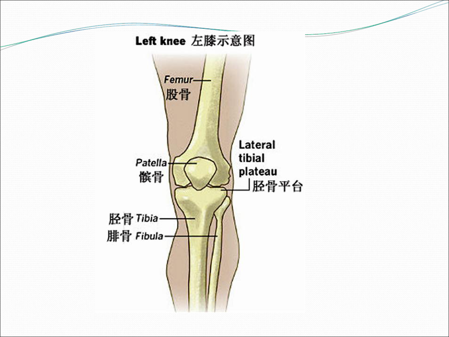 胫骨平台骨折的护理最新版本课件.ppt_第2页