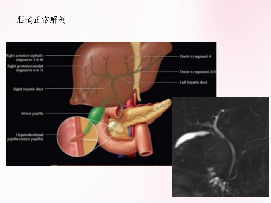 胆系疾病的影像诊断医学课件.pptx_第3页