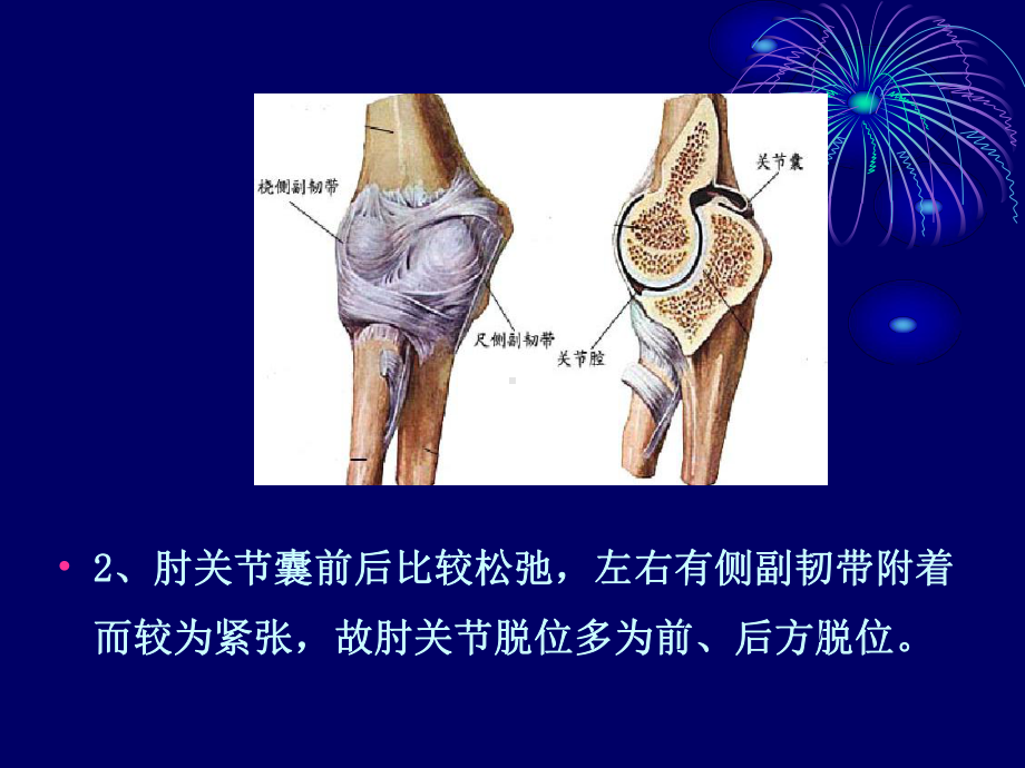 肘关节脱位—中医课件.ppt_第3页