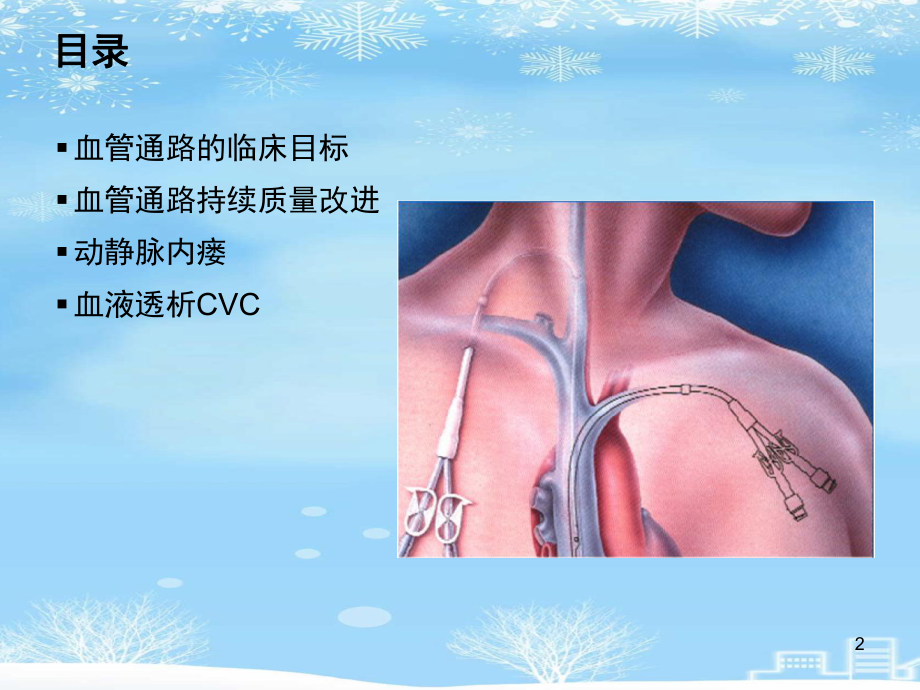 血液透析用血管通路专家共识2021完整版课件.ppt_第2页