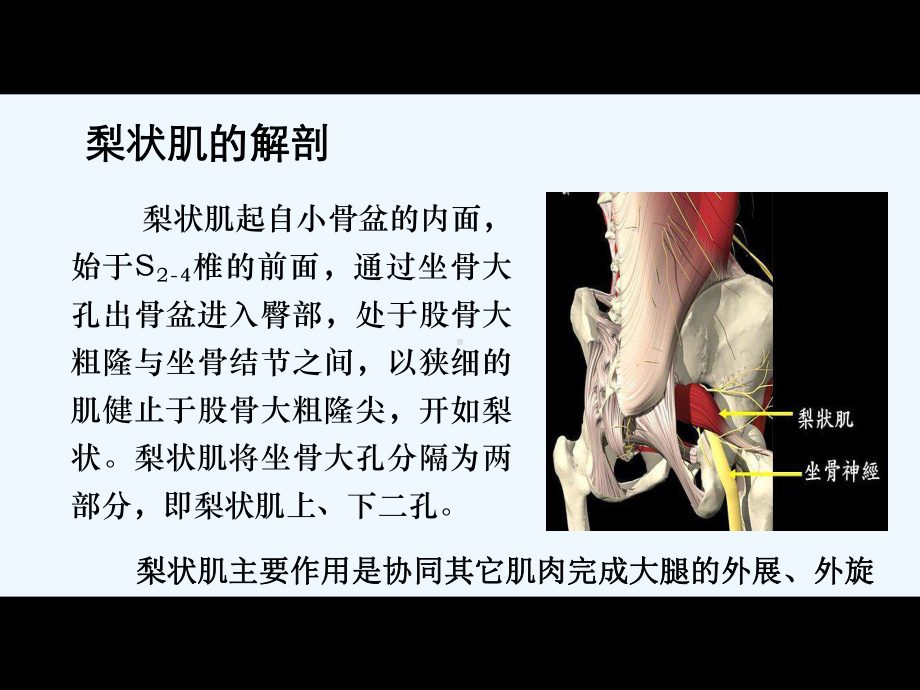 精选梨状肌综合征讲义课件.ppt_第3页