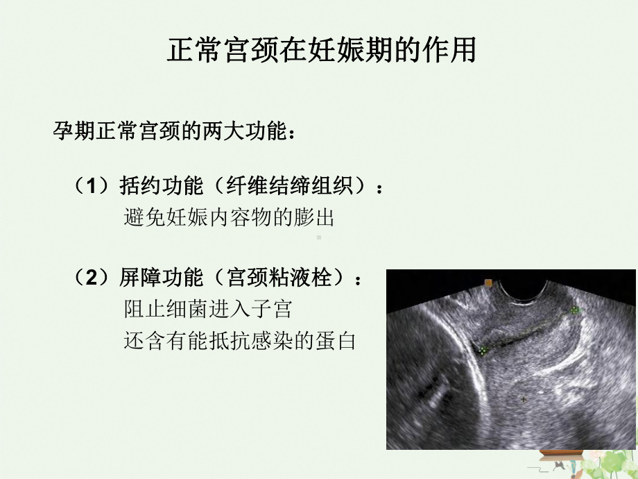 紧急宫颈环扎术的手术指征及术后管理讲课课件.ppt_第3页