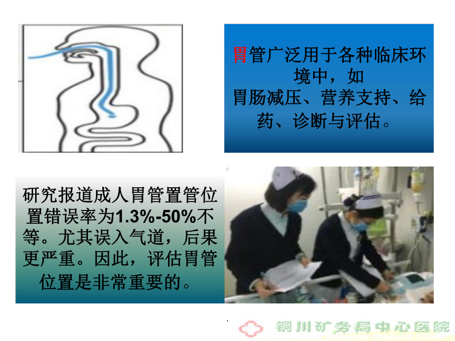 胃肠管位置判断和常见方法和误区课件.ppt_第3页