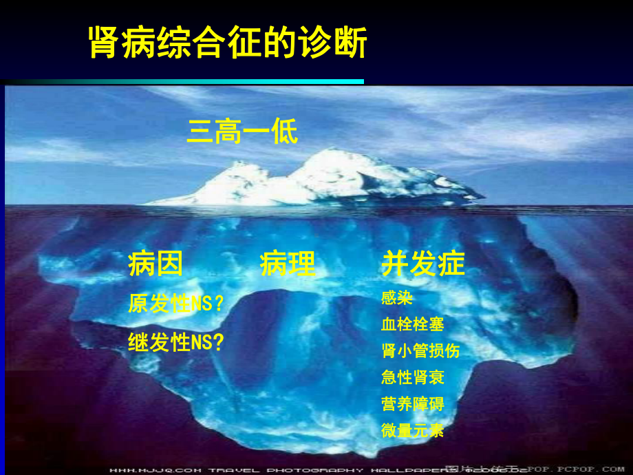 肾病综合征并发症的发病机制与干预策略-课件.ppt_第2页