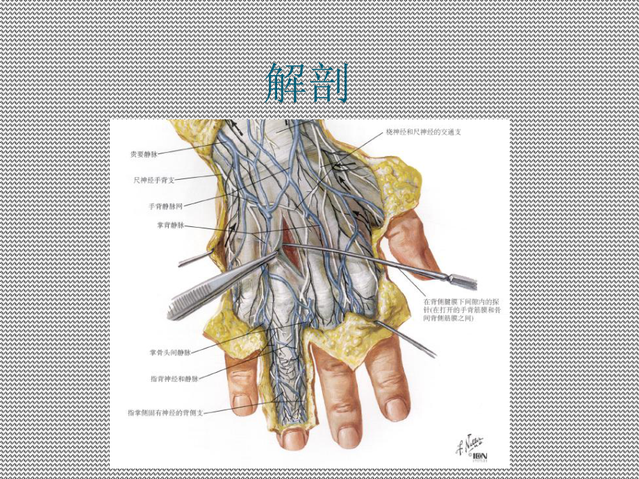 第五掌骨颈骨折演示教学课件.ppt_第2页