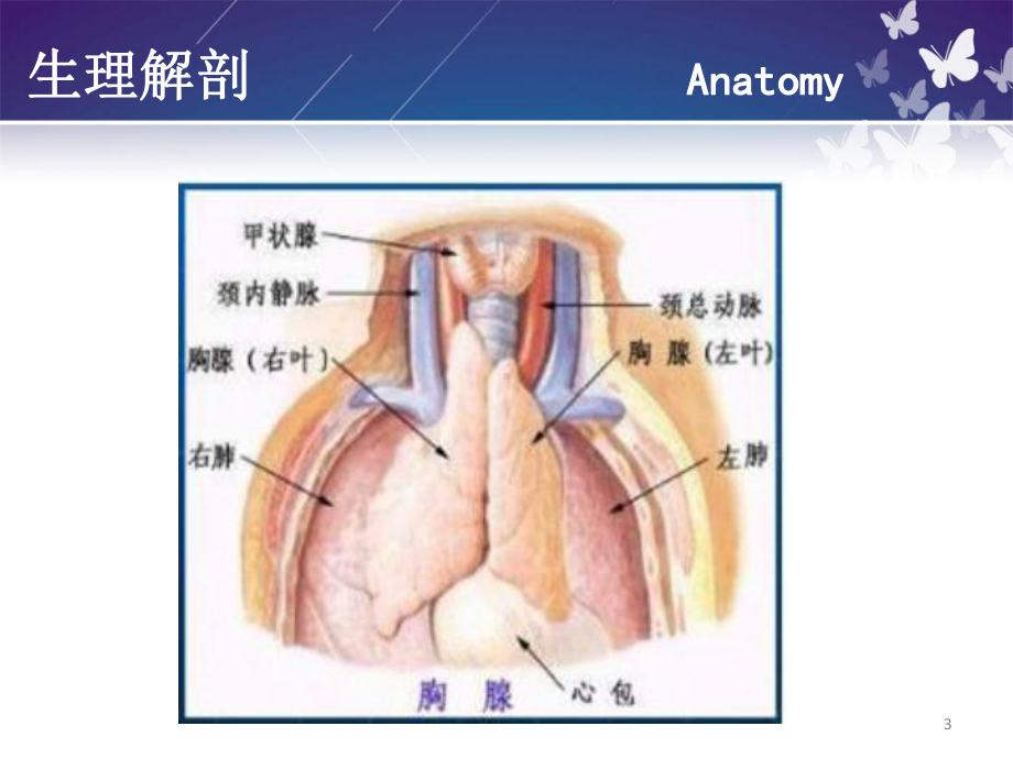 胸腺瘤围手术期护理课件最新版.ppt_第3页