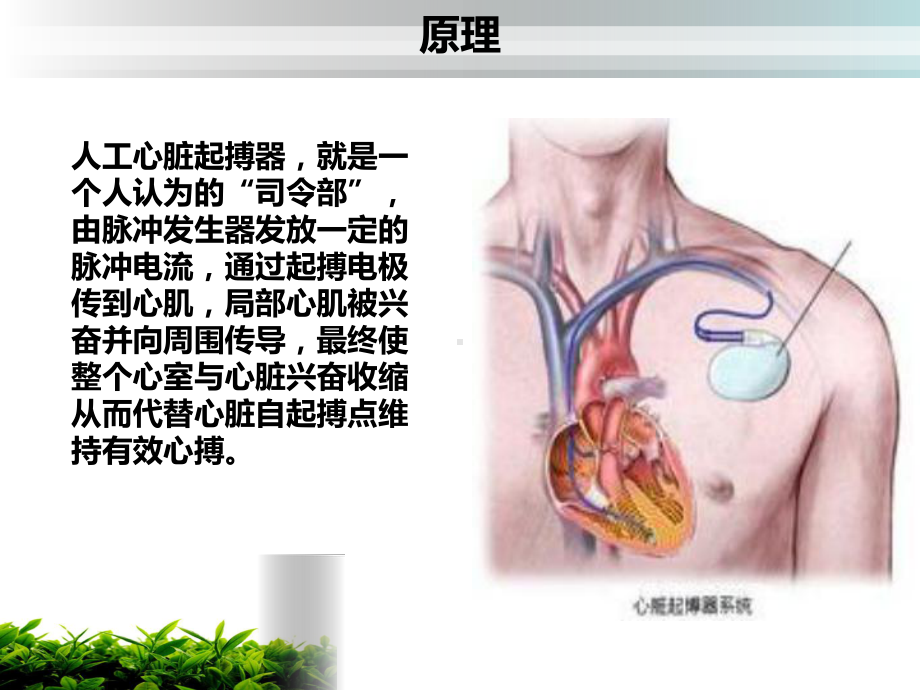 起搏器植入术的健康教育课件.ppt_第3页