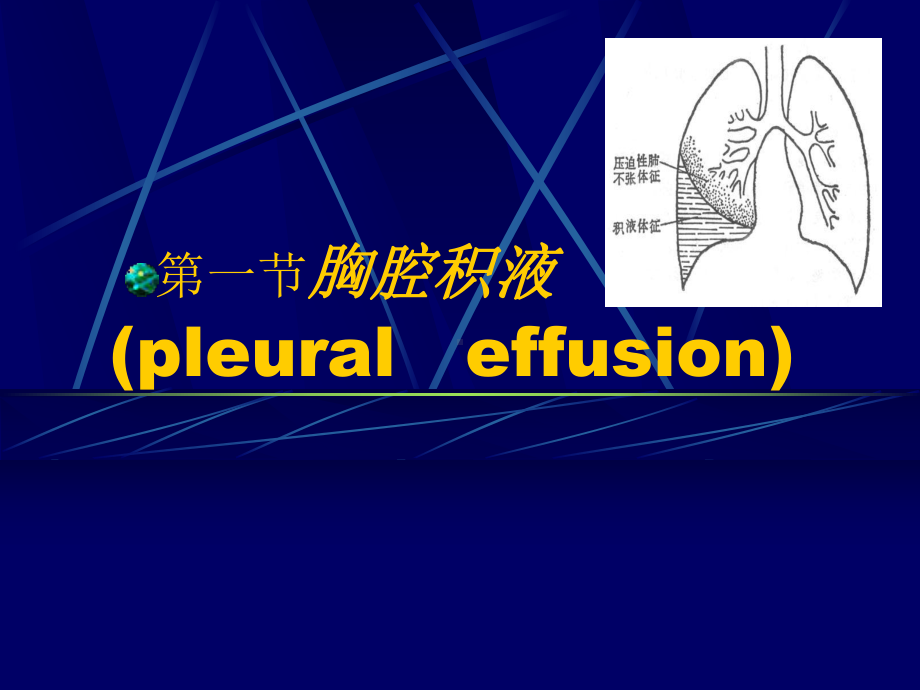 胸膜疾病[课件].pptx_第3页