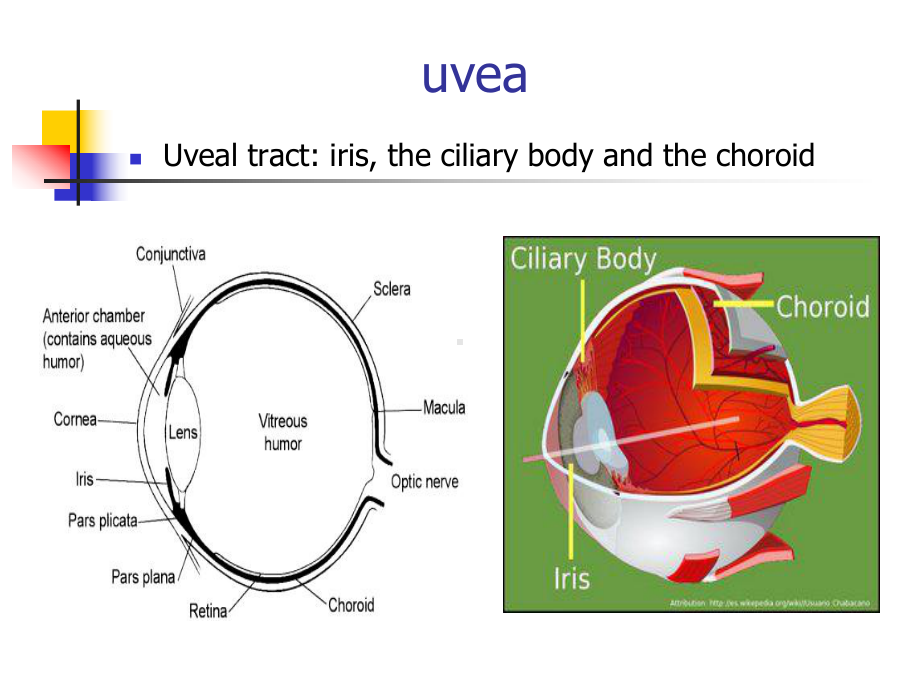 眼科学：英文-葡萄膜疾病课件.ppt_第2页