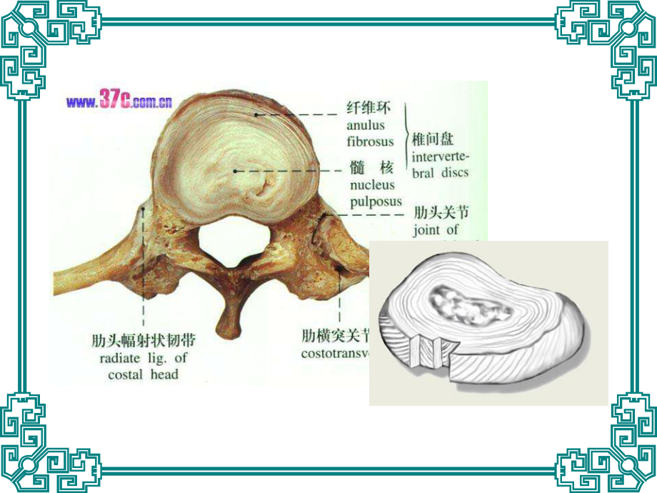 腰椎间盘突出症课件(同名69).ppt_第3页