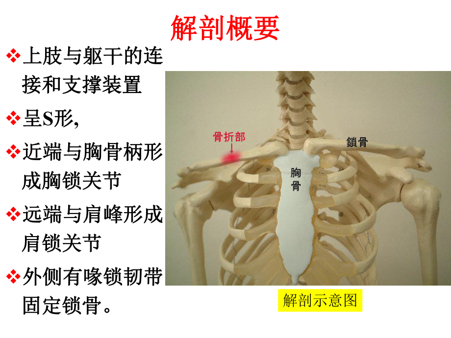 医学课件外科上肢骨关节损伤.pptx_第3页