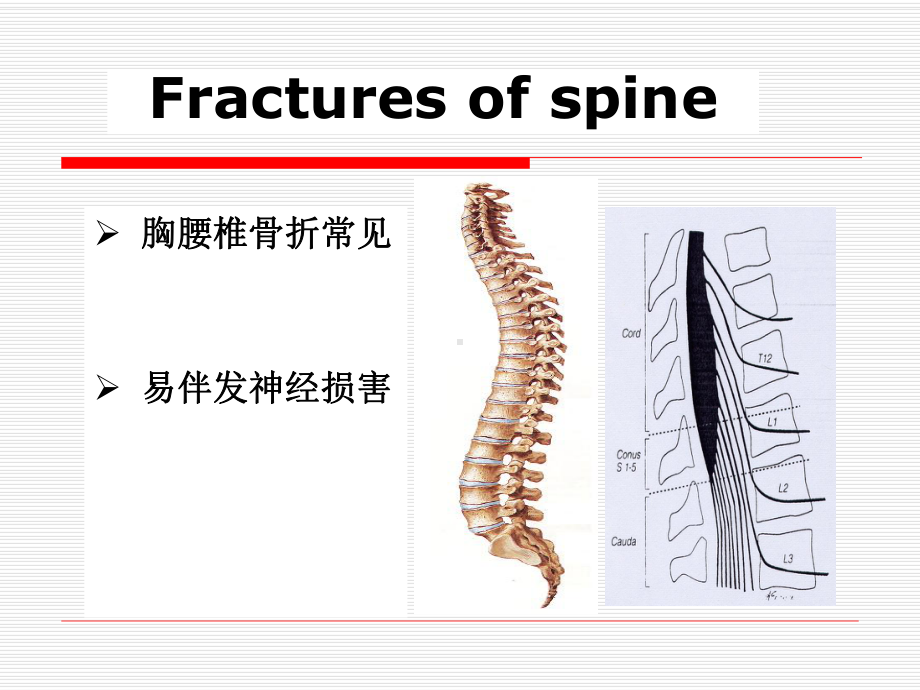 医学课件外科教学脊柱骨盆骨折.pptx_第3页