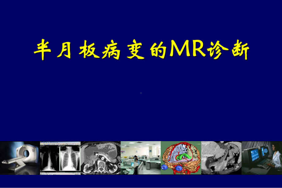 医学影像诊断课件膝关节半月板病变MR诊断.pptx_第1页