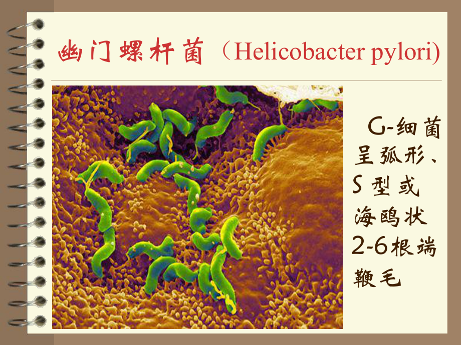 医学微生物学课件幽门螺杆菌.pptx_第3页