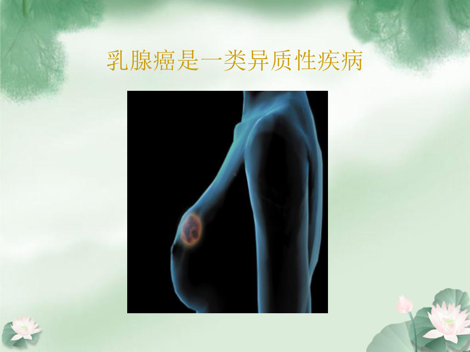 医学课件乳腺癌病例讨论.pptx_第2页