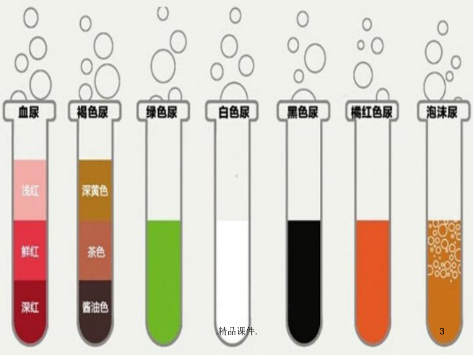 尿颜色的奥秘合集课件.ppt_第3页