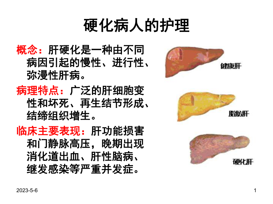 肝硬化病人的护理课件讲义.ppt_第1页