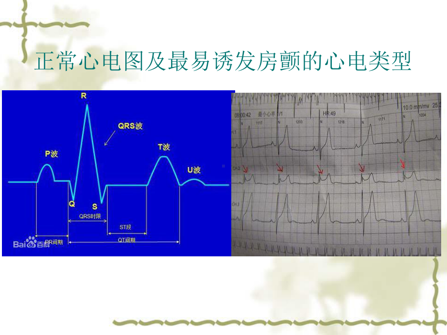 除颤仪的使用演示文稿课件.ppt_第3页