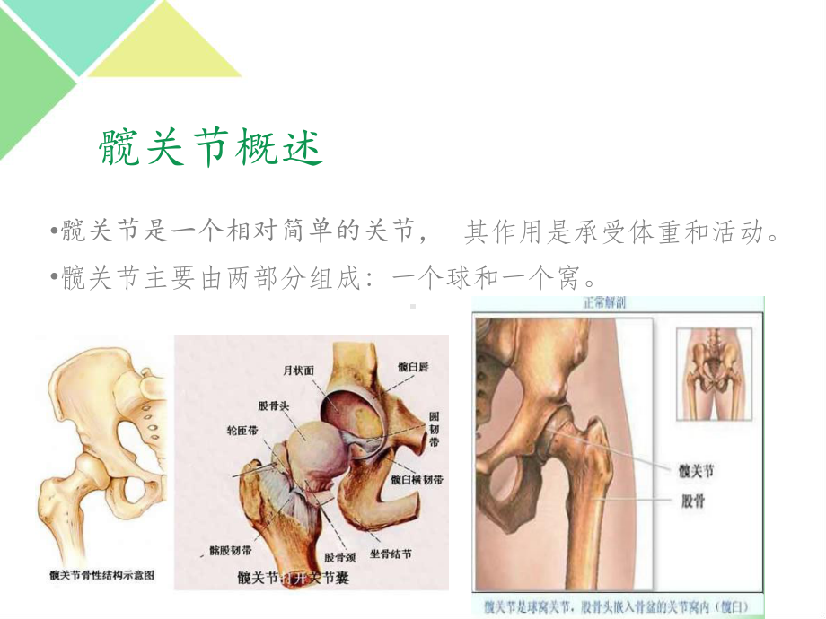 髋关节置换术后护理最新版本课件.ppt_第2页