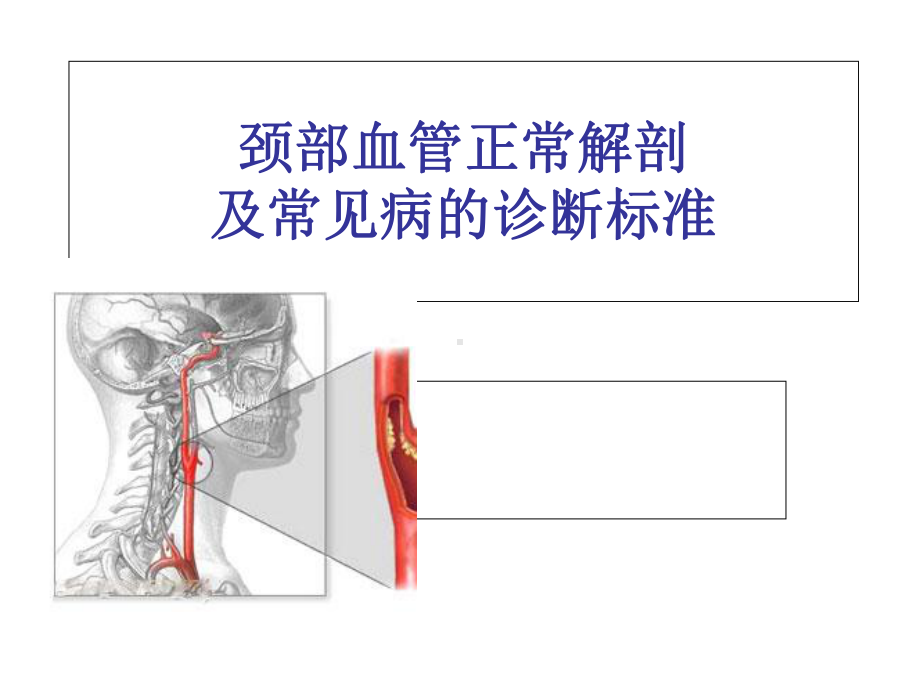 颈部血管超声正常解剖及常见病的超声诊断标准课件.ppt_第1页