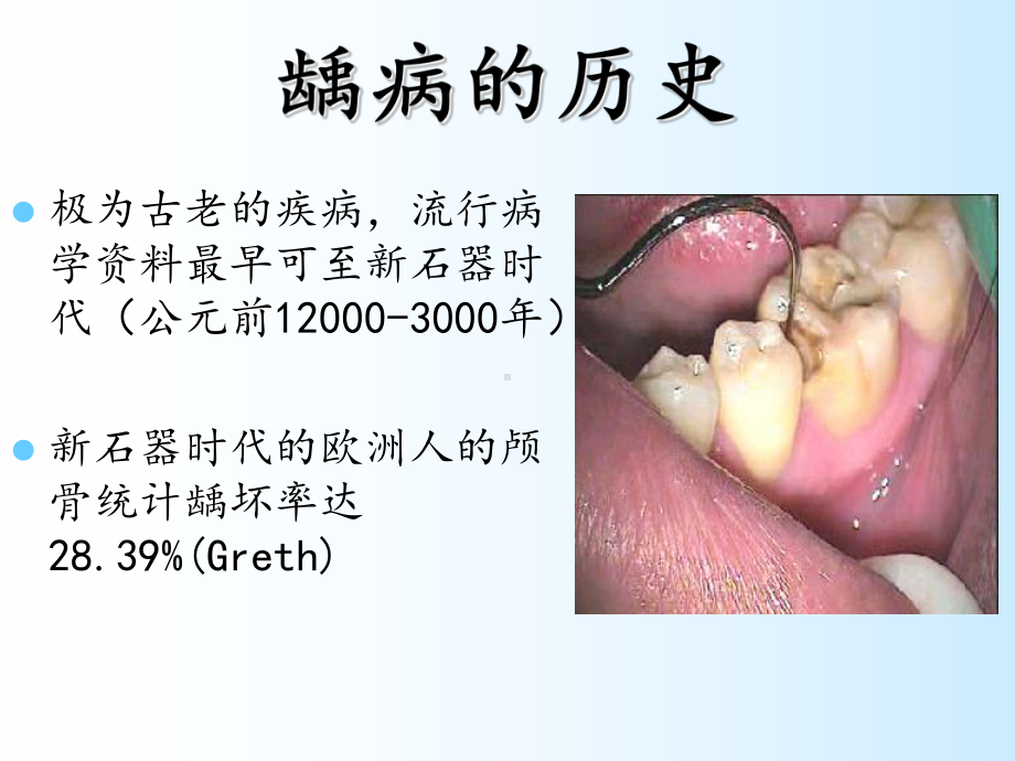 龋病病因、临床表现课件.ppt_第3页