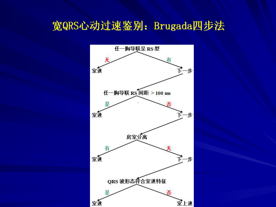 室速诊断及射频消融治疗课件.ppt_第2页