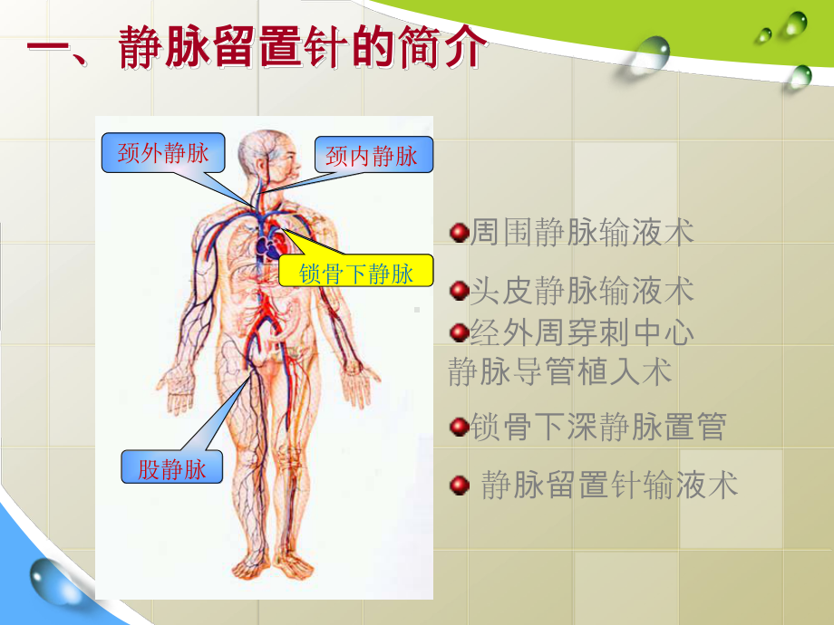 静脉留置针常见并发症预防及护理课件.pptx_第3页